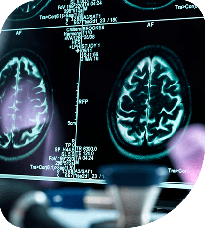 Neurologia